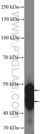 GATM Antibody in Western Blot (WB)