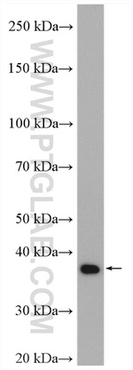 VPS26A Antibody in Western Blot (WB)