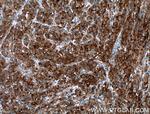 SEPT6 Antibody in Immunohistochemistry (Paraffin) (IHC (P))