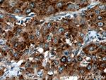 SEPT6 Antibody in Immunohistochemistry (Paraffin) (IHC (P))
