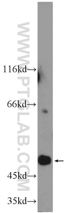 SEPT6 Antibody in Western Blot (WB)