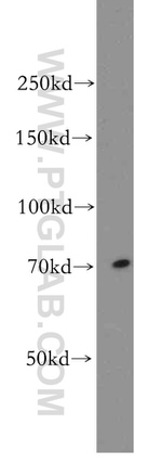 BACE1 Antibody in Western Blot (WB)