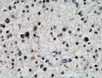 ARNT2 Antibody in Immunohistochemistry (Paraffin) (IHC (P))