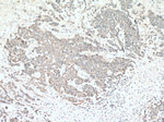 TRPM8 Antibody in Immunohistochemistry (Paraffin) (IHC (P))