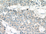 TRPM8 Antibody in Immunohistochemistry (Paraffin) (IHC (P))
