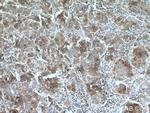 TRPM8 Antibody in Immunohistochemistry (Paraffin) (IHC (P))