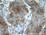 TRPM8 Antibody in Immunohistochemistry (Paraffin) (IHC (P))