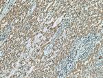TRPM8 Antibody in Immunohistochemistry (Paraffin) (IHC (P))