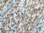 TRPM8 Antibody in Immunohistochemistry (Paraffin) (IHC (P))