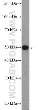 LRAT Antibody in Western Blot (WB)