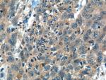 ITPKB Antibody in Immunohistochemistry (Paraffin) (IHC (P))