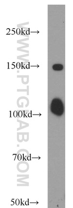 ITPKB Antibody in Western Blot (WB)