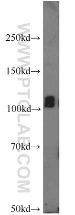 ITPKB Antibody in Western Blot (WB)