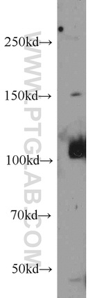 ITPKB Antibody in Western Blot (WB)