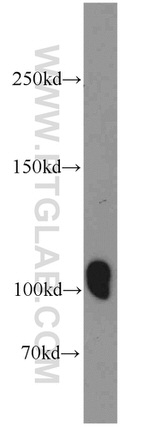 ITPKB Antibody in Western Blot (WB)
