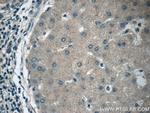 APOM Antibody in Immunohistochemistry (Paraffin) (IHC (P))