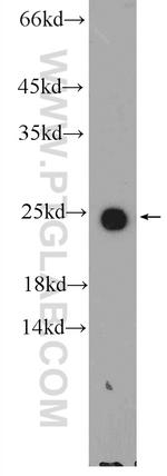 APOM Antibody in Western Blot (WB)