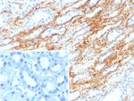 Collagen IV Recombinant Rabbit Monoclonal Antibody (COL4/8657R)