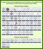 Collagen IV Antibody in Immunohistochemistry (Paraffin) (IHC (P))
