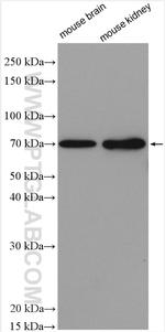 SLC20A2 Antibody in Western Blot (WB)