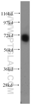 PAPOLB Antibody in Western Blot (WB)