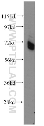PAPOLB Antibody in Western Blot (WB)