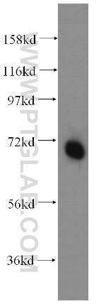 PAPOLB Antibody in Western Blot (WB)