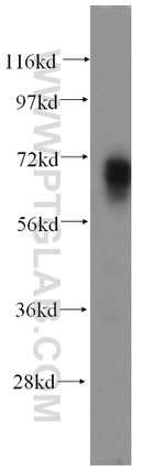 PAPOLB Antibody in Western Blot (WB)