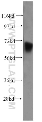 PAPOLB Antibody in Western Blot (WB)