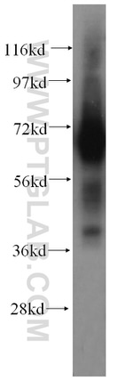 PAPOLB Antibody in Western Blot (WB)