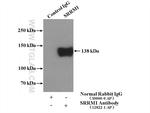 SRRM1 Antibody in Immunoprecipitation (IP)