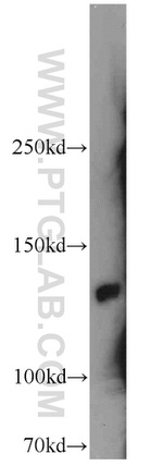 SRRM1 Antibody in Western Blot (WB)