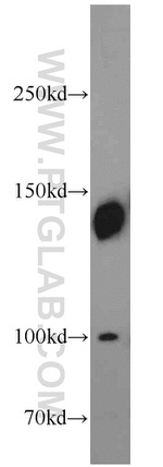 SRRM1 Antibody in Western Blot (WB)