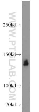 SRRM1 Antibody in Western Blot (WB)