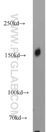 SRRM1 Antibody in Western Blot (WB)