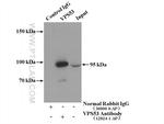 VPS53 Antibody in Immunoprecipitation (IP)