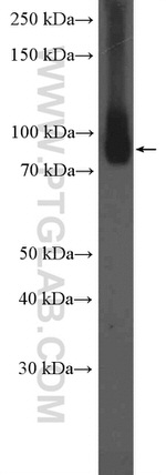 VPS53 Antibody in Western Blot (WB)