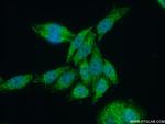 SUPV3L1 Antibody in Immunocytochemistry (ICC/IF)