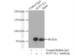 SUPV3L1 Antibody in Immunoprecipitation (IP)