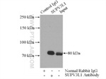 SUPV3L1 Antibody in Immunoprecipitation (IP)