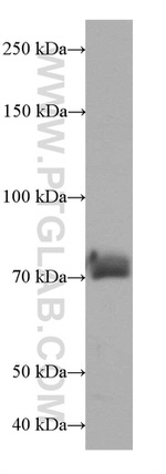 SUPV3L1 Antibody in Western Blot (WB)