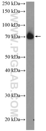 SUPV3L1 Antibody in Western Blot (WB)