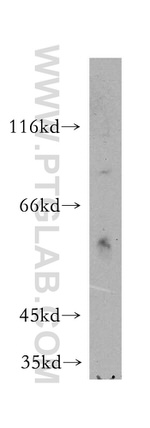 MAP4K5 Antibody in Western Blot (WB)
