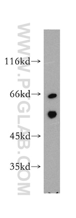 MAP4K5 Antibody in Western Blot (WB)