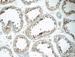SPACA1 Antibody in Immunohistochemistry (Paraffin) (IHC (P))
