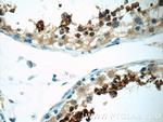 SPACA1 Antibody in Immunohistochemistry (Paraffin) (IHC (P))