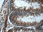 Alpha E catenin Antibody in Immunohistochemistry (Paraffin) (IHC (P))