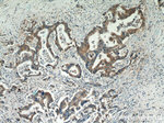 Alpha E catenin Antibody in Immunohistochemistry (Paraffin) (IHC (P))