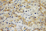 Alpha E catenin Antibody in Immunohistochemistry (Paraffin) (IHC (P))