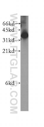 GIPC2 Antibody in Western Blot (WB)